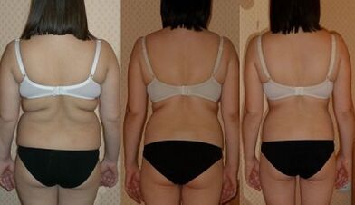 spôsoby, ako schudnúť 7 kg za týždeň